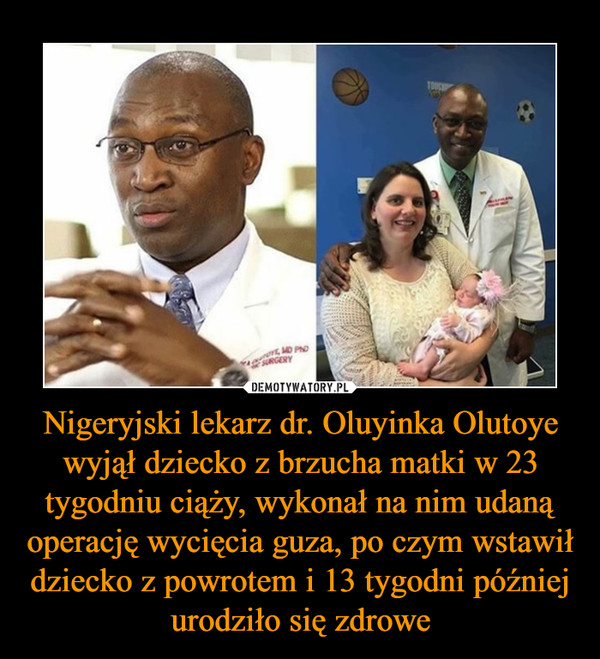 Nigeryjski lekarz dr. Oluyinka Olutoye wyjął dziecko z brzucha matki w 23 tygodniu ciąży, wykonał na nim udaną operację wycięcia guza, po czym wstawił dziecko z powrotem i 13 tygodni później urodziło się zdrowe –  